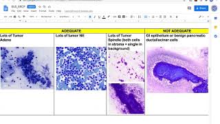 Rapid Onsite Evaluation of EUSERCP Dr Hoda Amer [upl. by Aihseyn]