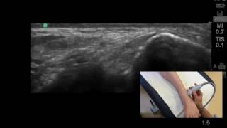 How to visualise the anterior talofibular ligament on ultrasound [upl. by Kalam]