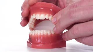 How patients should apply OrVance® Temporary Tooth Repair [upl. by Bartolemo]