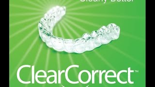 Clear Aligner Treatment with ClearCorrect™ [upl. by Wilonah260]