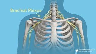 What Is Brachial Plexus Injury  Boston Children’s Hospital [upl. by Phio]