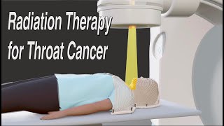 Throat Cancer Radiation Therapy  Long Version [upl. by Zeph642]