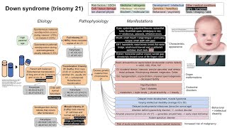 Down Syndrome  explained simply  Trisomy 21 [upl. by Gaulin]