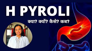 H Pylori Test in Hindi  HPylori Test क्या हैं कैसे किया जाता है [upl. by Yemorej458]