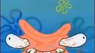 Patrick beats himself up earrape [upl. by Ethelin]