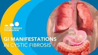 NACFC 2020 GI Manifestations in Cystic Fibrosis [upl. by Evette]