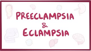 Preeclampsia amp eclampsia  causes symptoms diagnosis treatment pathology [upl. by Akemed183]