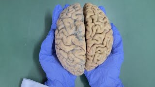 CEREBRUM  An overview Part 1  NEUROANATOMY  HUMAN BRAIN [upl. by Macleod379]