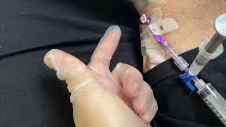 How to delcot a PICC CVC central line catheter with thrombolytic enzymes Alteplase cathflo turorial [upl. by Auqenes]