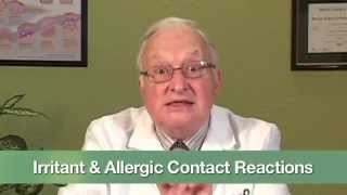 Irritant amp Allergic Contact Reactions [upl. by Finnie]