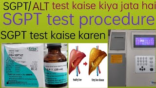 SGPTALT test kaise kiya jata hai  sgpt test procedure  sgpt test kaise karen  sgpt test [upl. by Viviane568]