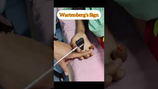 Wartenberg’s Sign  Finger flexion reflex medicalvideos shorts neurology [upl. by Hines]