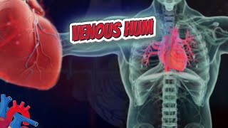 Venous hum  Human Heart ❤️ and Cardiology ❤️🔊✅ [upl. by Teemus]