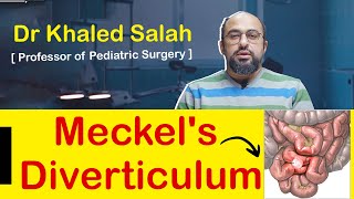 Meckels diverticulum medical students and pediatric surgeons [upl. by Aubigny727]