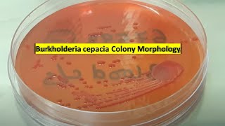 Burkholderia cepacia growth on Macconkey agar [upl. by Knipe122]