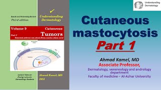 Cutaneous Mastocytosis Part 1 [upl. by Wulfe813]