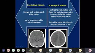 increased intracranial pressure [upl. by Hodosh]