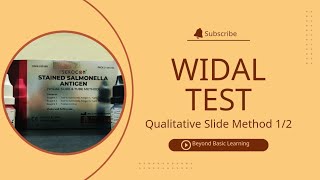 Widal Test  Qualitative Slide method  12 [upl. by Biron92]