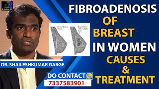 Fibroadenoma of Breast in Women Causes amp New Treatment in Telugu  Citi Vascular Centre [upl. by Petta]