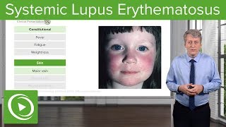 Systemic Lupus Erythematosus SLE in Children – Pediatrics  Lecturio [upl. by Ellezig965]