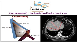 Liver segments CT  Liver anatomy  Caudate anatomy  liver imaging  Understanding CT scan [upl. by Kristel]