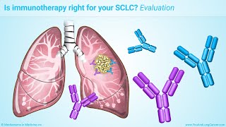 Immunotherapy Treatments for Small Cell Lung Cancer SCLC [upl. by Aldredge612]