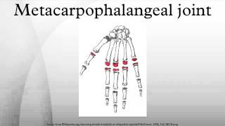 Metacarpophalangeal joint [upl. by Plantagenet]