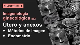 111  Imagen Ginecológica Métodos de estudio y patología endometrial [upl. by Sitra667]