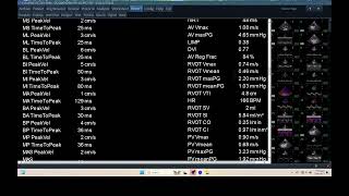 IQ 296 HEMODYNAMIC ECHOPAC ANALYSIS ECHOCARDIOHRAPHY HWD REPORT [upl. by Jule]