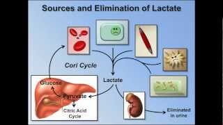 Elevated Anion Gap Metabolic Acidosis ABG Interpretation  Lesson 8 [upl. by Enimajneb]