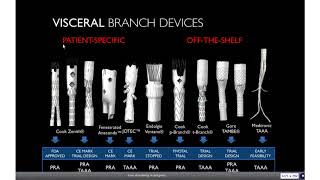 MitraClip Procedure For Mitral Regurgitation Patients [upl. by Okiron483]