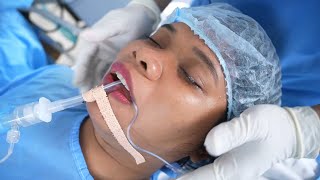 Young Women Slowly losing Consciousness under General Anesthesia [upl. by Elyrad]