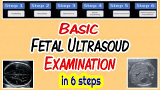 Basic Fetal Ultrasound Examination [upl. by Baptiste]