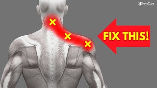 How to INSTANTLY Fix Pinched Nerve Pain in the Neck and Shoulders [upl. by Retsevel]