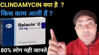 dalacin c 150 mg capsule use in hindi clindamycin capsule [upl. by Awra]