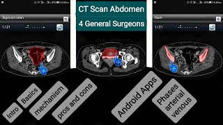 CT scan Abdomen for General Surgeons PartA [upl. by Mlehliw]