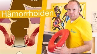 Hämorrhoiden ⚡️ Erkennen Behandeln amp Hilfsmittel [upl. by Hirza]