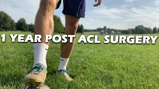 1 YEAR POST ACL SURGERY [upl. by Anaibaf]