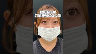 15秒で分かる松田医師のクマ取り🐻 目のクマ クマ取り 美容 目の下のクマ 若返り 青クマ 黒クマ [upl. by Natsirt772]