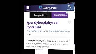 Spondyloepiphyseal dysplasia [upl. by Agnese36]