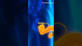 Testicular Torsion A MustKnow for Future Doctors medicalshorts SurgeryTips TesticularTorsion [upl. by Anilok]