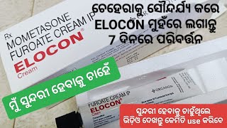 ମୁଁ ସୁନ୍ଦରୀ ହେବାକୁ ଚାହେଁ  Elocon  Mometasone Furoate Cream  ଚେହେରା ସୌନ୍ଦର୍ଯ୍ୟ ବଢ଼ାନ୍ତୁ 7ଦିନରେ [upl. by Cioffred272]