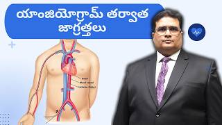 Coronary Angiogram After Care in Telugu  యాంజియోగ్రామ్ తరువాత జాగ్రత్తలు [upl. by Deer993]