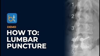 How To Do A Lumbar Puncture Procedure  BackTable Demo [upl. by Ahtiekal]