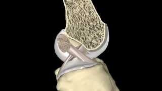 The ACL During Knee Range of Motion [upl. by Morse]