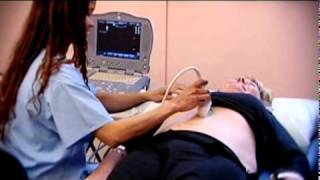 Abdominal Aortic Aneurysm  Health Screening  Life Line Screening [upl. by Heloise587]