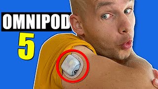 Omnipod 5  Full Review  This is it [upl. by Yralam620]