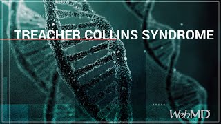 The Basics Treacher Collins Syndrome  WebMD [upl. by Nileuqaj]