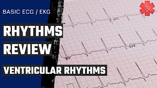 Basic ECG EKG Part 4 Ventricular Rhythms [upl. by Kore183]