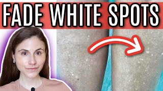 How to FADE WHITE SPOTS from SUN DAMAGE  Dr Dray [upl. by Crow]